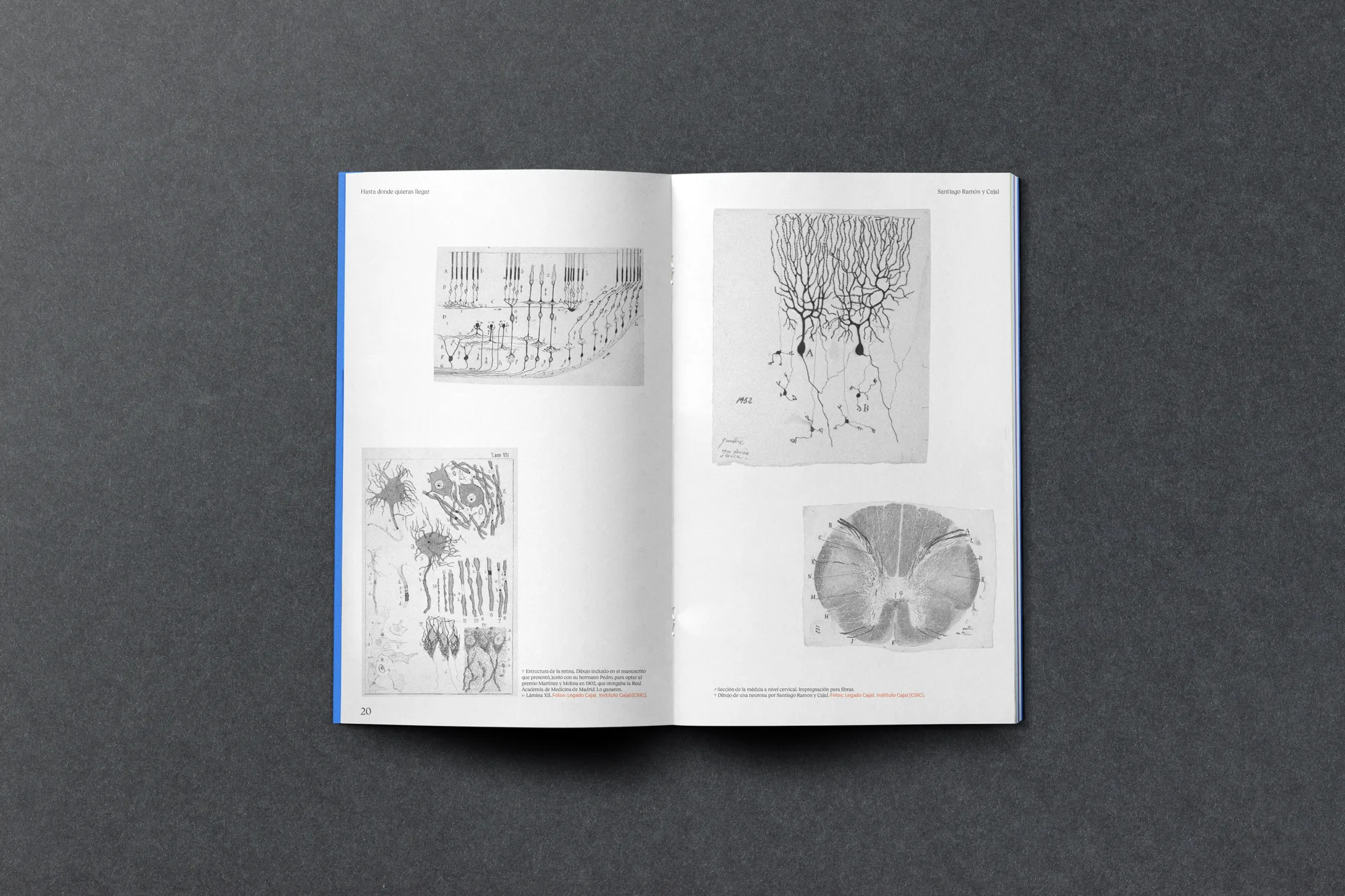 Ramón y Cajal — imagen 6 del proyecto